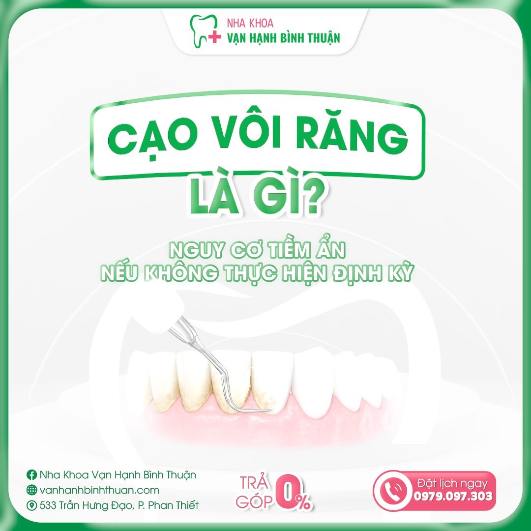 Cạo vôi răng là gì? Nguy cơ tiềm ẩn nếu không thực hiện định kỳ